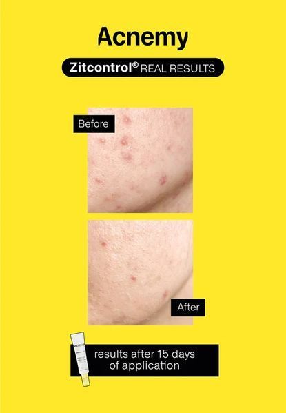 Крем для проблемної шкіри Acnemy Zitcontrol 40ml 000002 фото